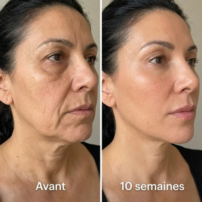 Le masque qui sculpte le visage et la mâchoire.