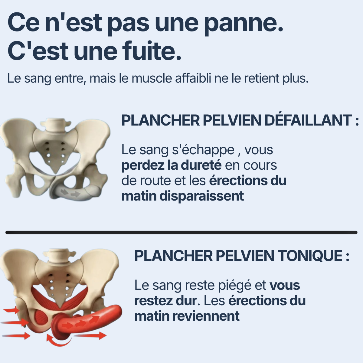 PlancherPelvien Pro