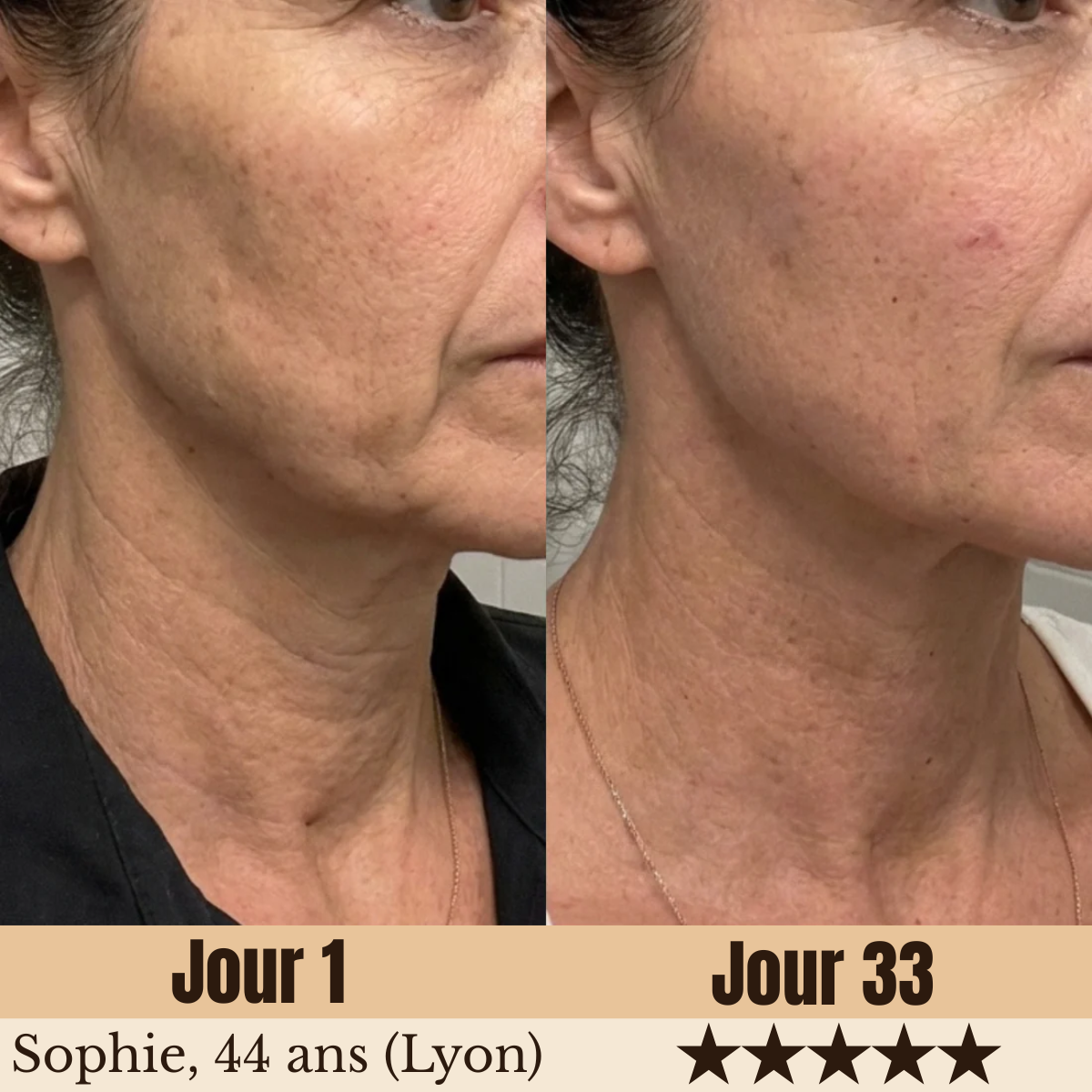 SculptLED Pro 7-en-1