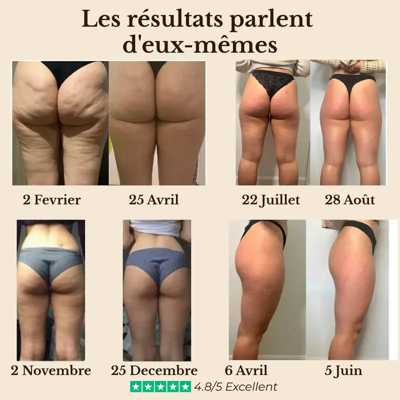 Legging 3D Anti-Cellulite 3D V2